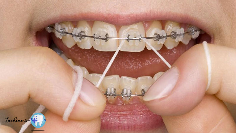 بهداشت دهان و دندان ضروری است