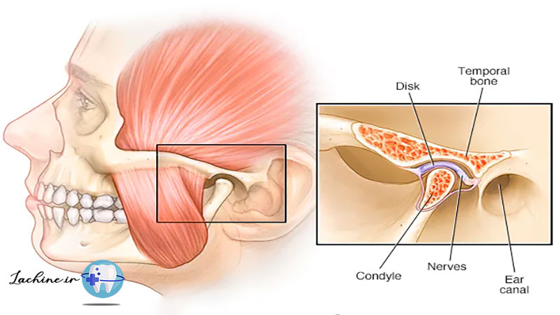 مفصل تمپورومندیبولار
