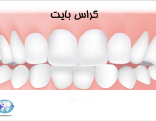 کراس بایت