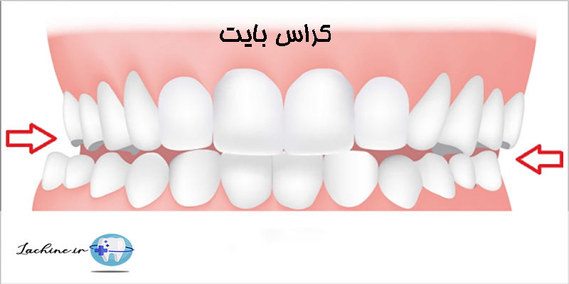 کراس بایت