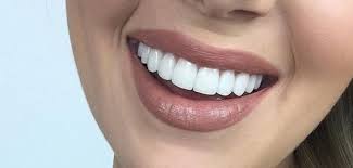 دندان و زیبایی