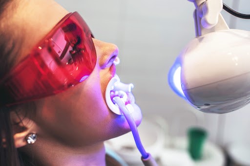 کاربرد لیزر در سفیدسازی دندان