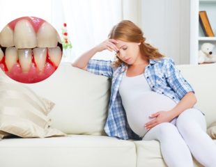دندان پزشکی در دوران بار داری