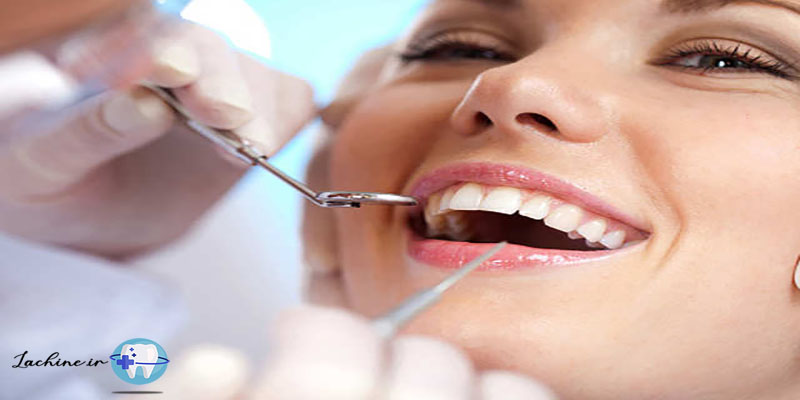 کانتورینگ دندان برای روکش